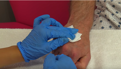 Infant Oro-Nasopharyngeal Suctioning